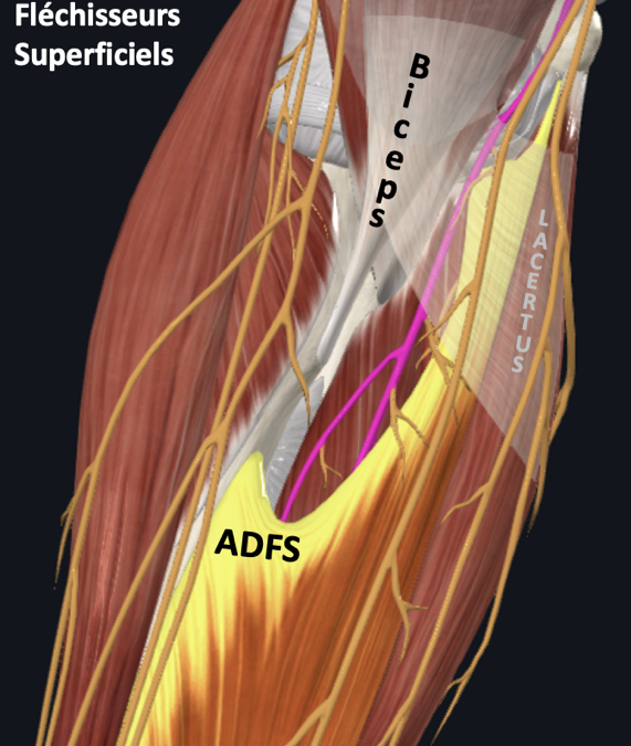 Opération pour un syndrome de l’ADF